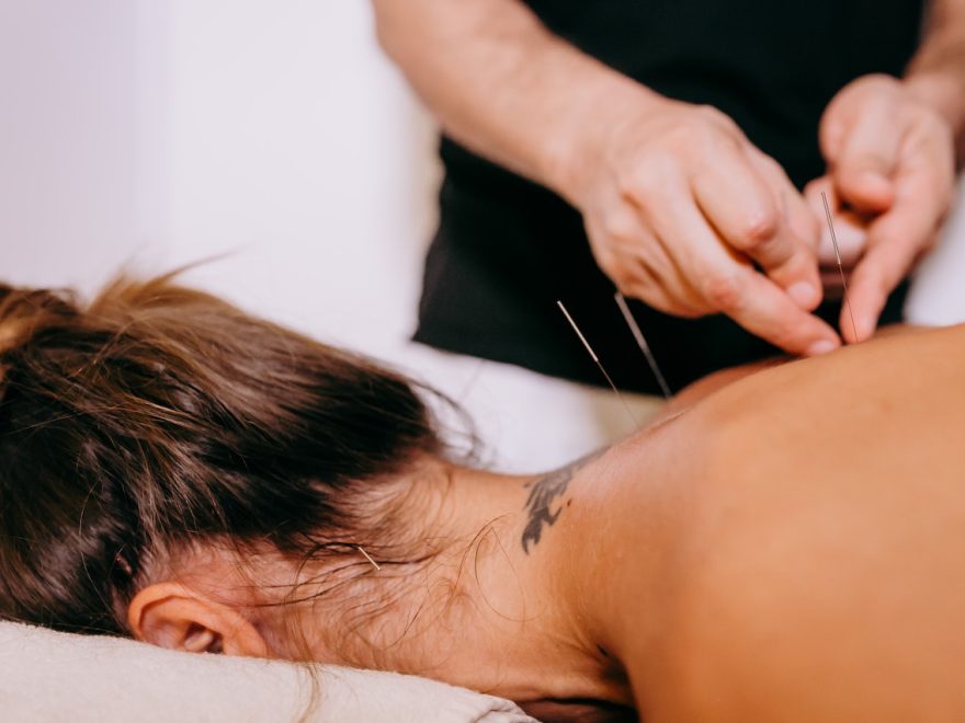 Precisa ser médico para fazer acupuntura?